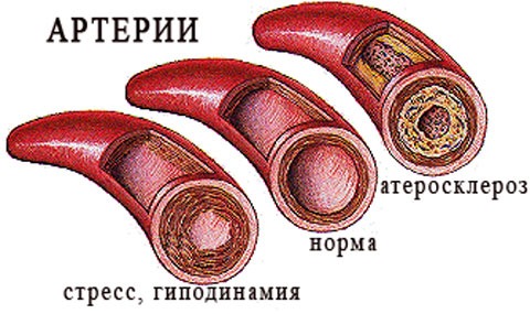 Разжижение крови