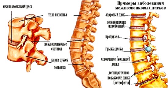 Боль в спине