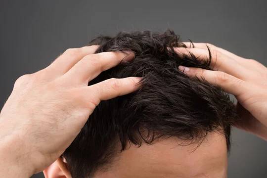 Средства для восстановления волос для мужчин - обзор топ-8