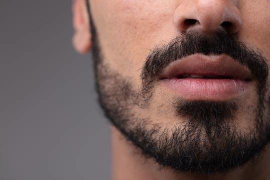 Этапы роста бороды: этапы роста на фото по дням и неделям