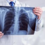 Рентген: для чего проводится и как правильно подготовиться к процедуре